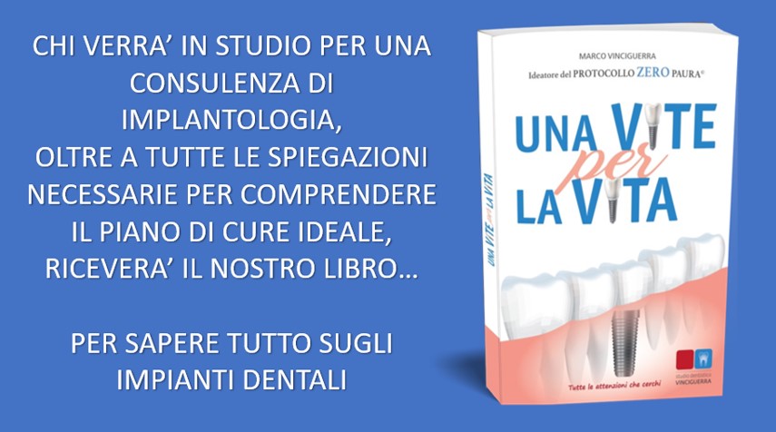 Hai bisogno di sapere tutto sugli impianti?